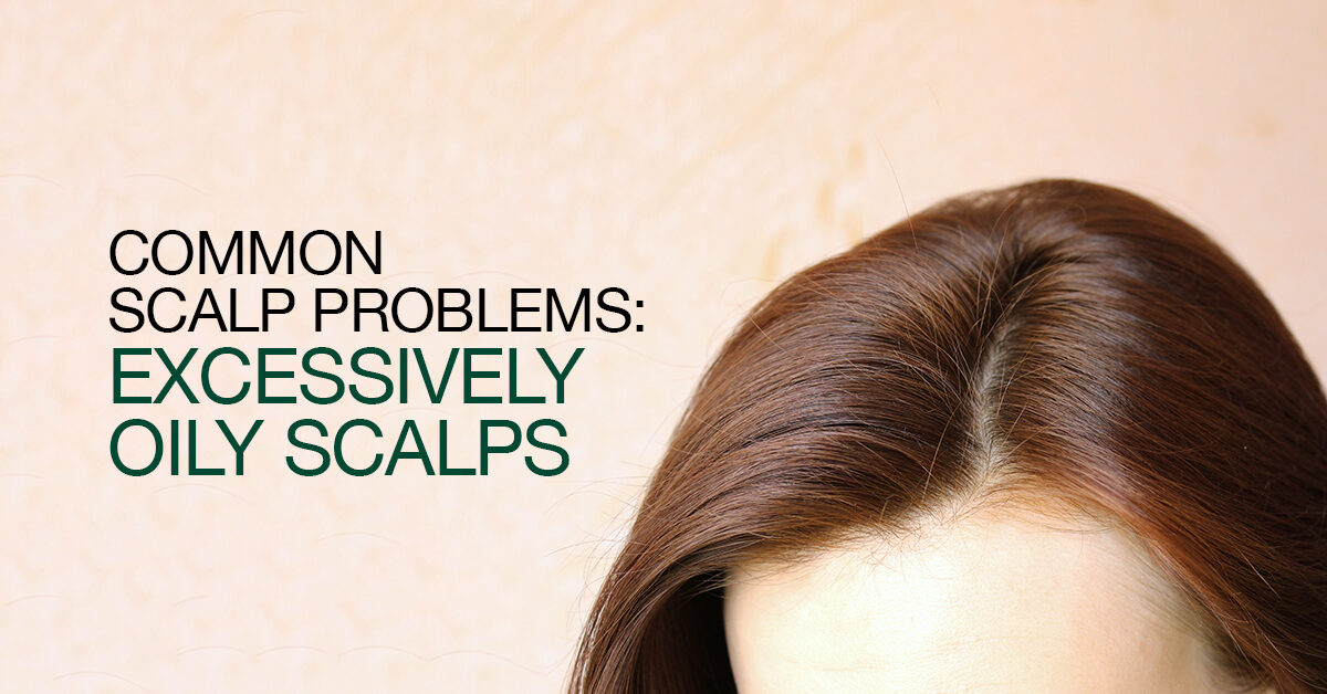 Oily Scalp: Causes & Treatment - Hair Scalp Problems | DrGL